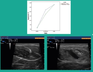 Eficacia de la técnica diatérmica dieléctrica DCD ® en el tratamiento de la regeneración muscular.